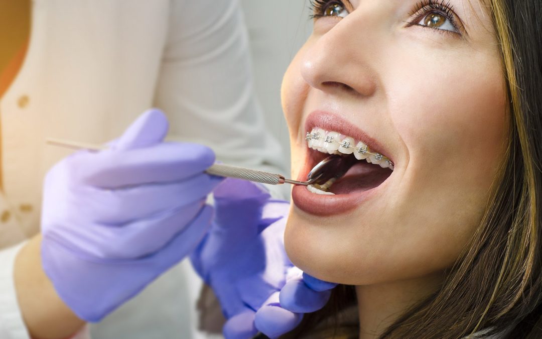 Pose de l’appareillage